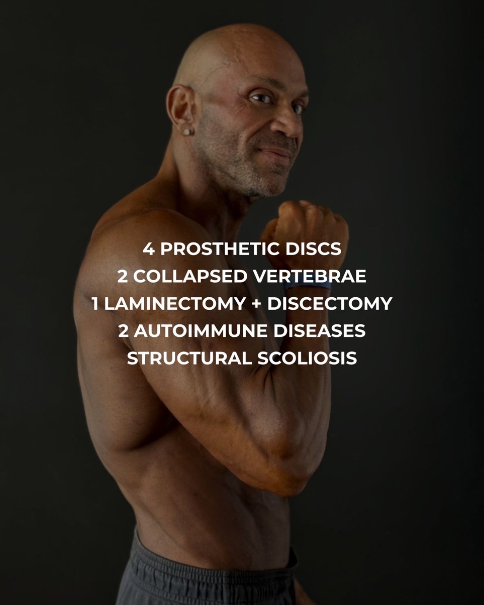 4 prosthetic discs
